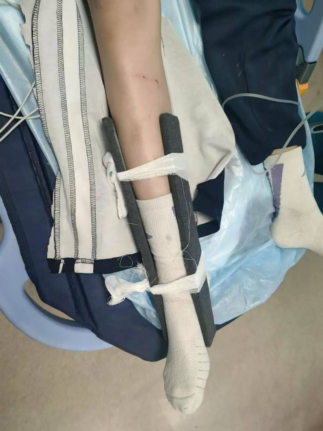 惨痛<strong></p>
<p>波卡币</strong>！一人身亡！深圳多名学生骑电动车发生意外