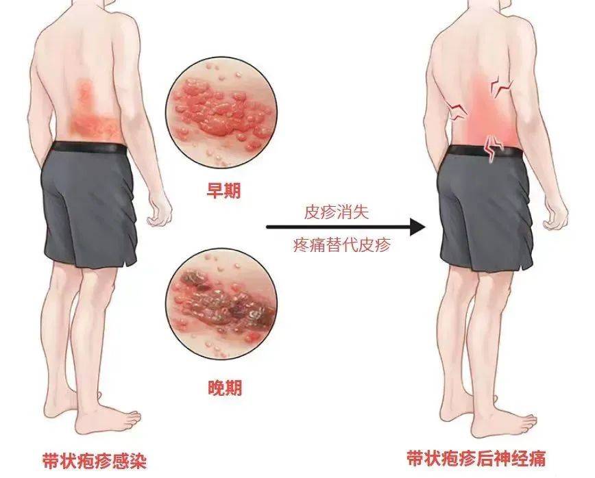 一旦感染终身携带<strong></p>
<p>OKEx交易</strong>！深圳疾控提醒：这4类人要注意