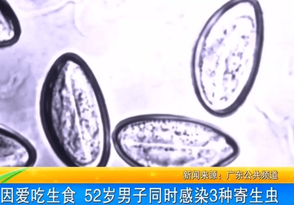 女子体内排出10米长绦虫<strong></p>
<p>以太坊交易</strong>！原是两年前旅游时吃了这种食物