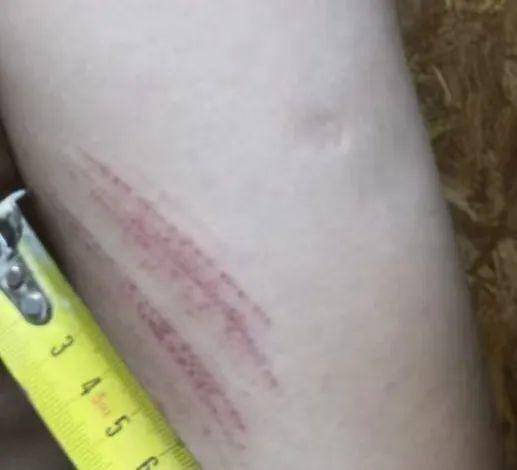 侄女与姑姑争祖父留下的门面<strong></p>
<p>喜洋洋</strong>，长沙租客“躺枪”：我被打了，店也被锁了！