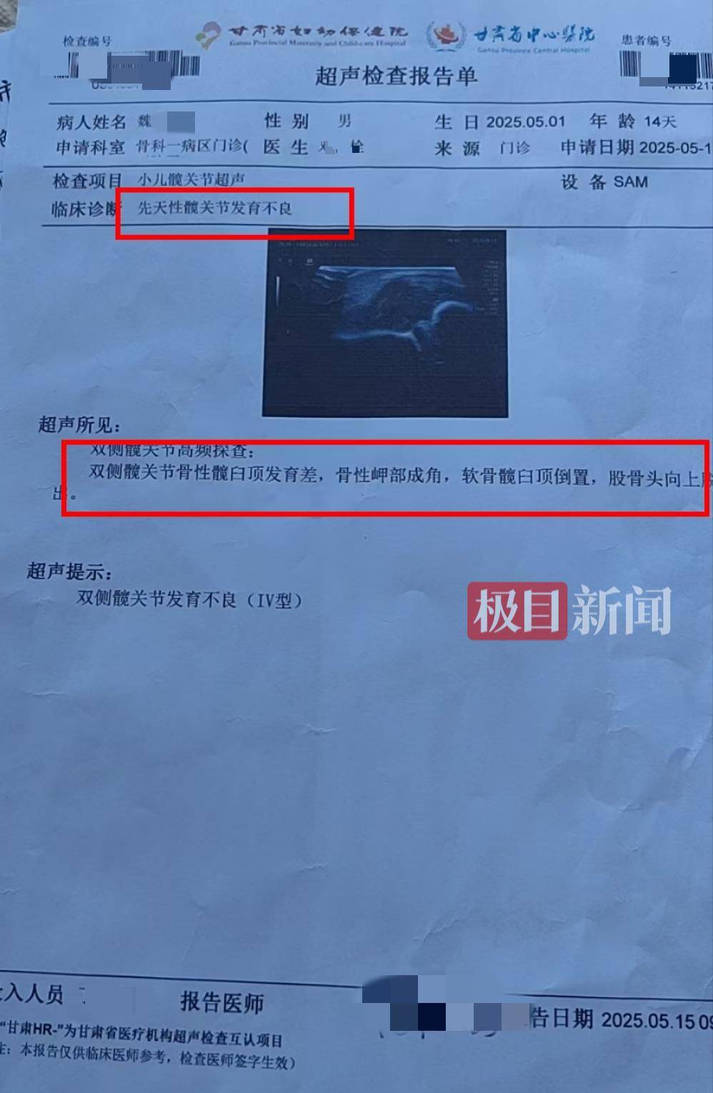 二胎出生查出先天性病症或落下残疾<strong></p>
<p>母婴</strong>，残疾父母称医院产检漏检、未尽告知义务，医院及医调委回应