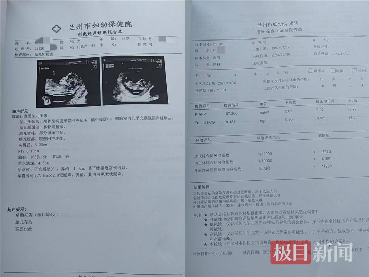 二胎出生查出先天性病症或落下残疾<strong></p>
<p>母婴</strong>，残疾父母称医院产检漏检、未尽告知义务，医院及医调委回应