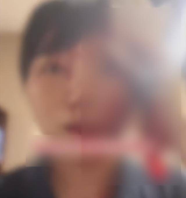 缝了20多针！女子称被不知名男同事砸头毁容<strong></p>
<p>比特币换人民币</strong>，警方介入