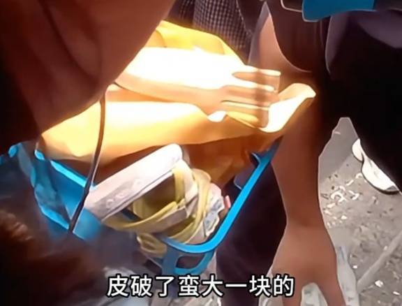 看着都疼<strong></p>
<p>比特儿海外</strong>!上海街头一男子突然求助:10岁女儿被死死卡住!这个行为太危险→