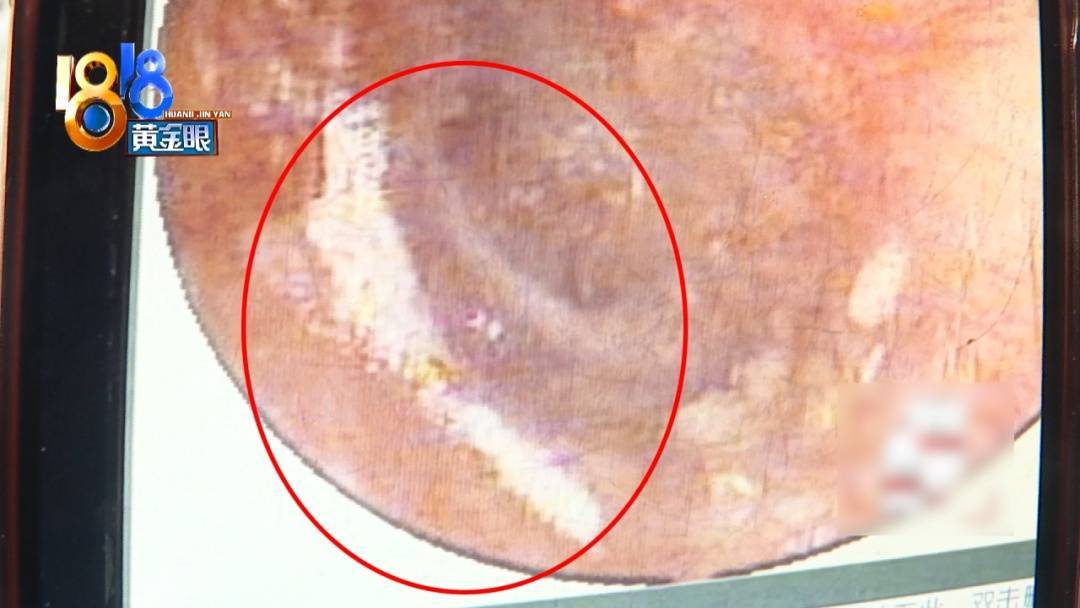 杭州姑娘痒了一整夜<strong></p>
<p>虚拟网领币</strong>,检查结果让她崩溃……浴场回应索赔:凭什么要两千?