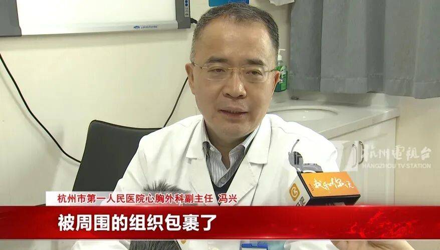 17岁小伙参军体检发现胸腔内有根5cm缝衣针<strong></p>
<p>中国出虚拟币</strong>,父母回忆或是1岁时扎入,取出时已锈迹斑斑